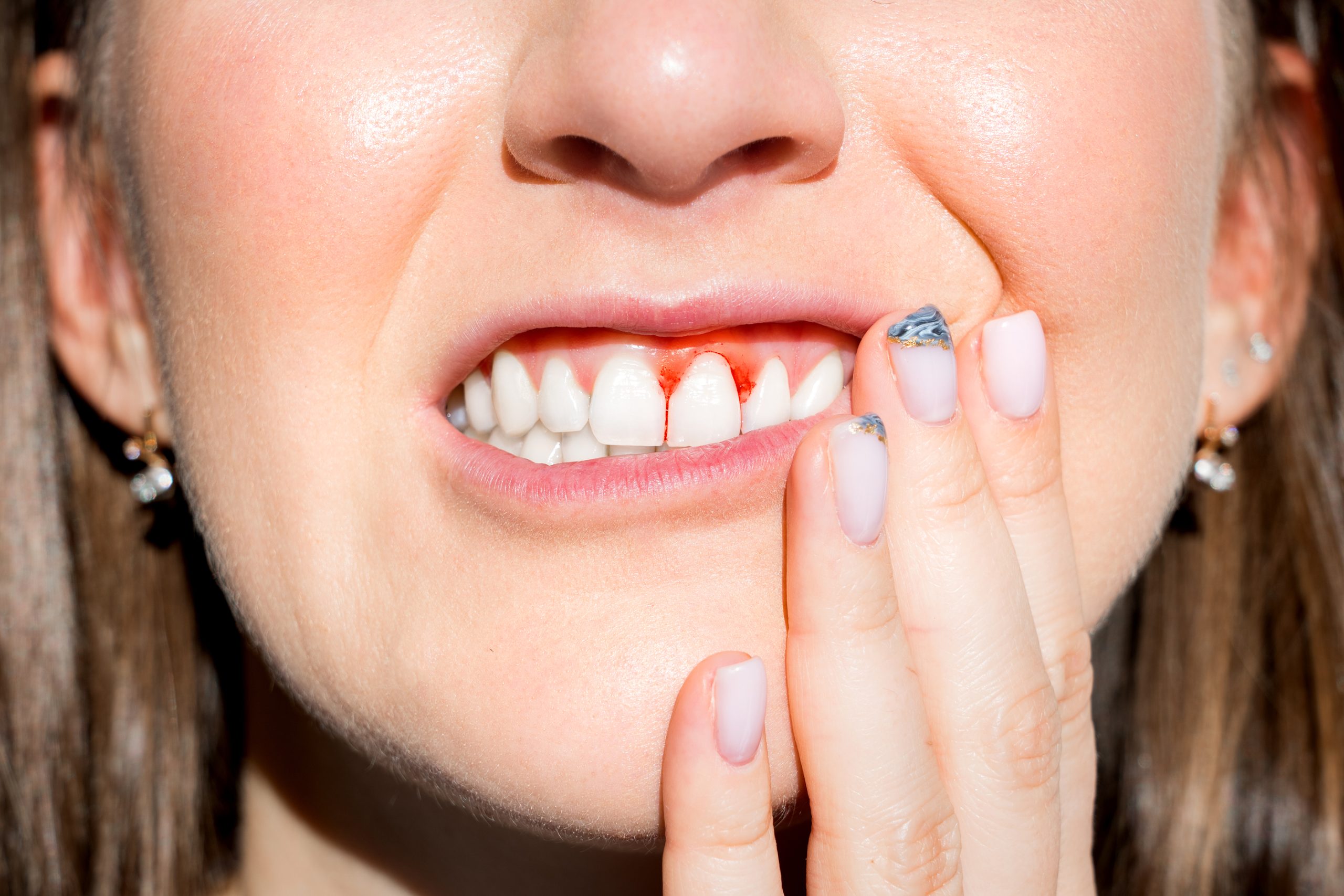 September is National Gum Care Month